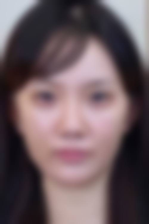 湘潭爱思特整形医院价格收费