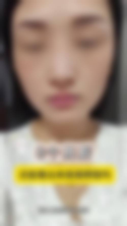 西安如伊医疗美容诊所价格收费