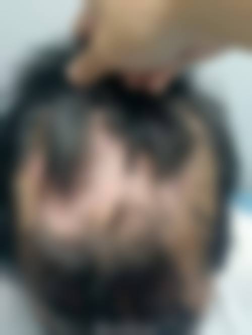 成都恒博植发植发专科医院来院路线