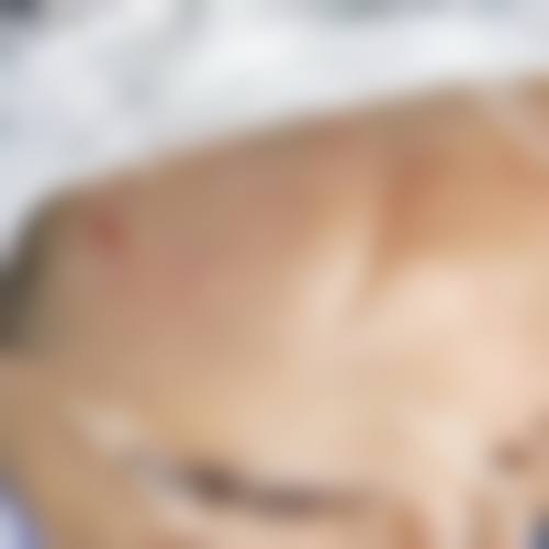 成都恒博植发植发专科医院预约指南