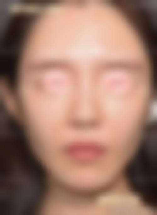 湘潭爱思特整形医院医生团队实力