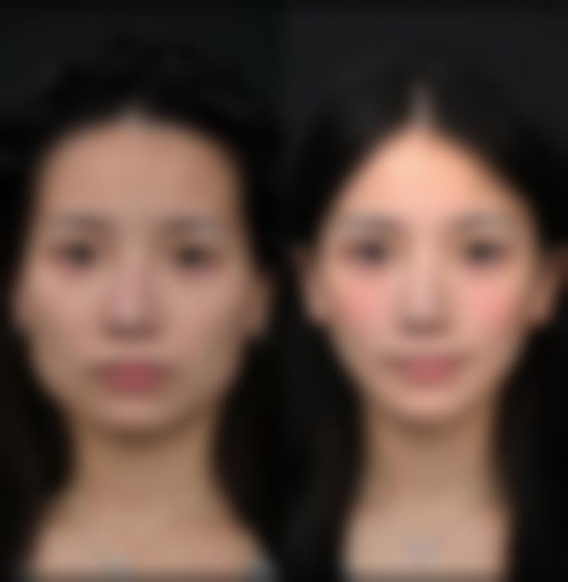 广元美华医学美容诊所求美者反馈