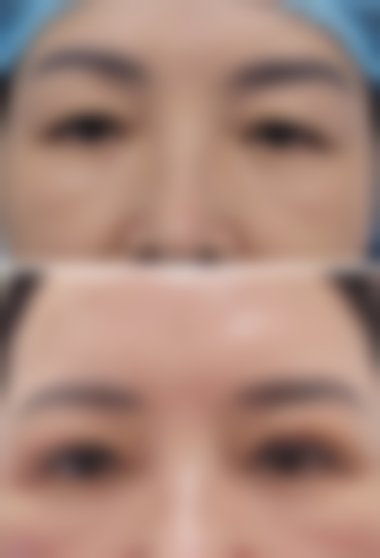 解放军总医院第一附属医院求美者反馈