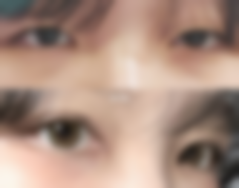 日本西山美容形成外科医院价格收费