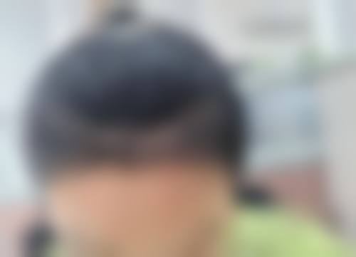 北京牛大夫（予馨美）植发医生团队实力