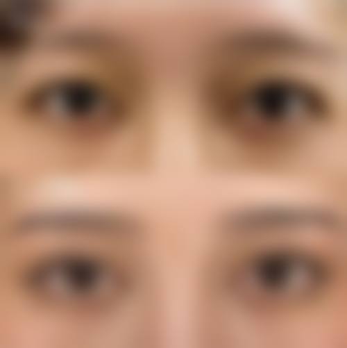 海城兰积靓颜博仕整形医院求美者反馈