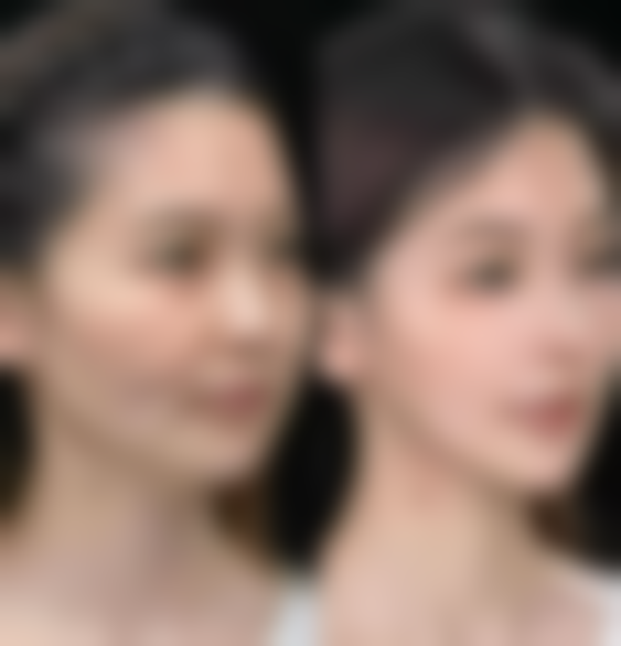 上海铂生医疗美容诊所价格收费