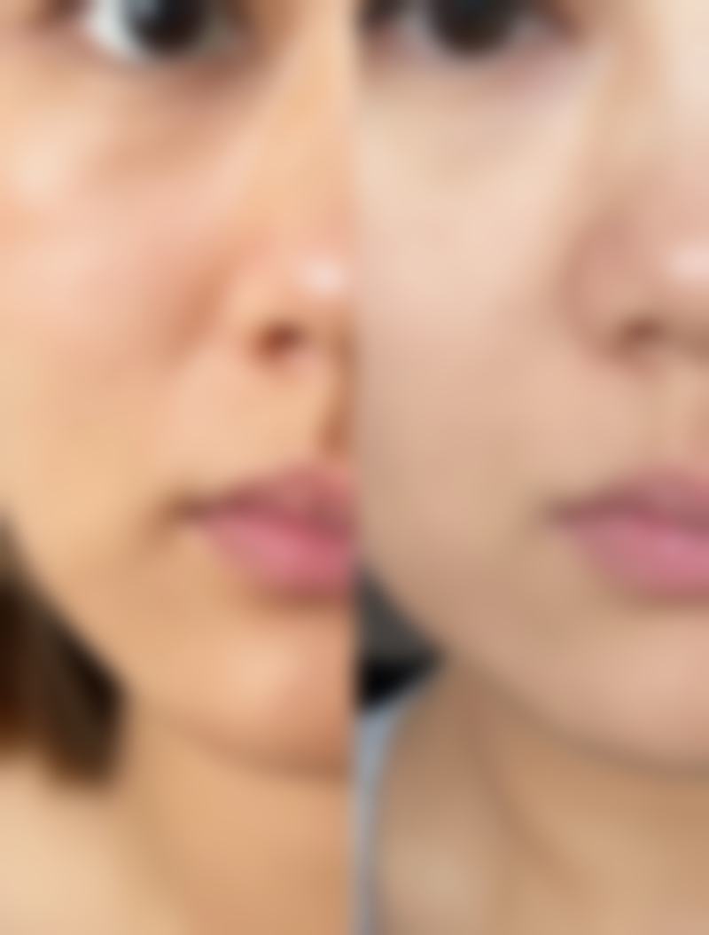 韩国鼻整形研究所（金永民医院）：24年专精医美诊疗的安心之选