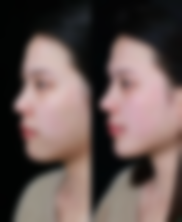 杭州鑫昕薇医疗美容门诊部价格收费