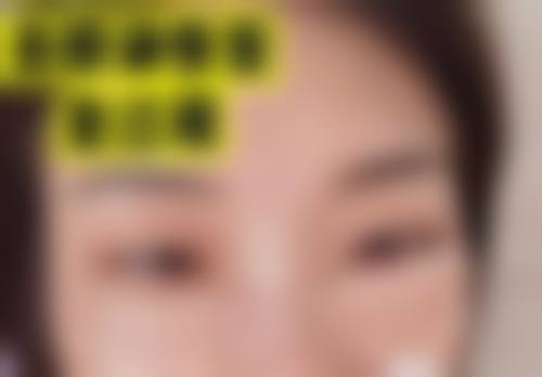 李广智医生:坚持规范操作,筑牢医美安心防线