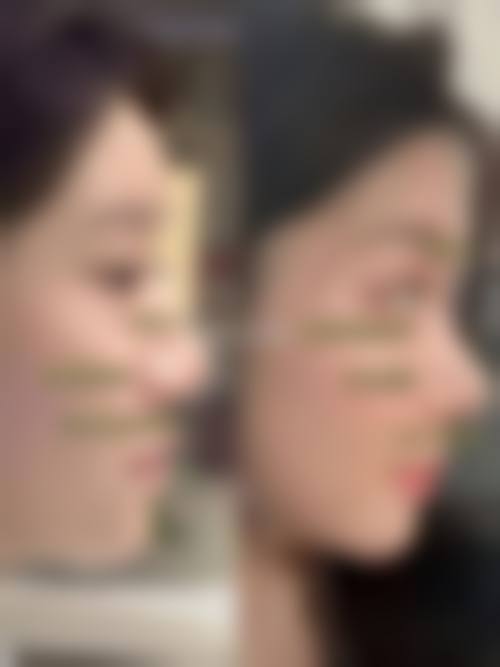 韩国欧娜尔整形外科价格收费