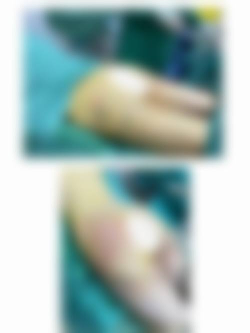 深圳微雅美拉医疗美容门诊部价格收费