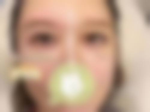 深圳微雅美拉医疗美容门诊部特色项目及技术优势