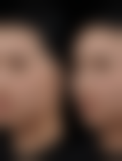 揭阳海珊整形美容医院服务特色