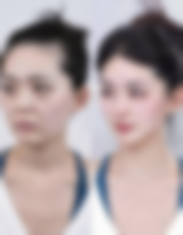 张长山以安心与个性化诊疗为核心原则