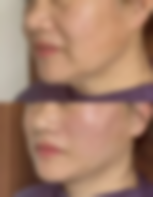 新乡红旗艺芳医疗美容诊所特色项目及技术优势