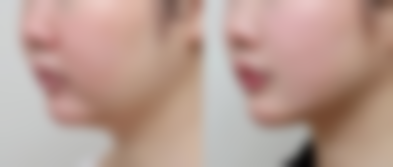 首都医 科 大学附属北京朝阳医院整形外科(京西院区)价格收费