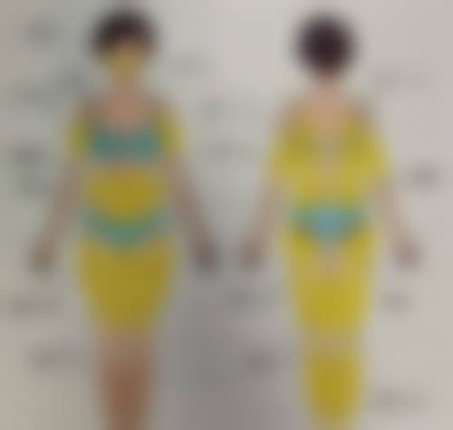 汉中市中 心医院(医疗美容·整形外科)求美者真实反馈