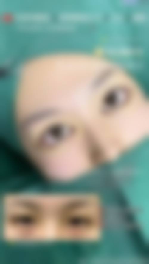 东莞美立方美容医院价格收费