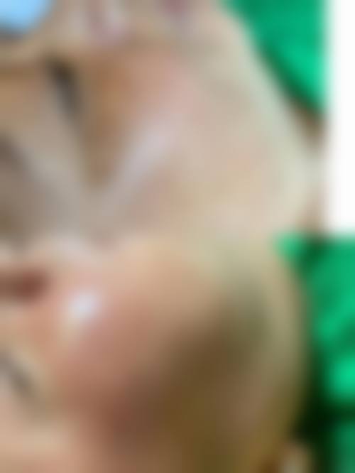 安庆慕颜医疗美容诊所特色项目及技术优势