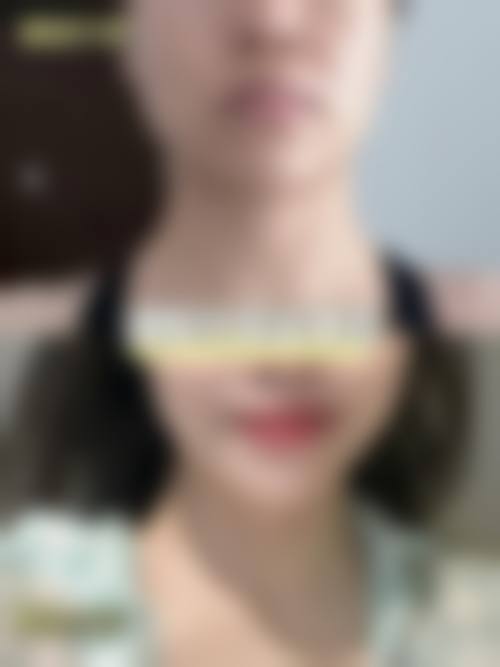 邢台美在人生医疗美容诊所求美者反馈