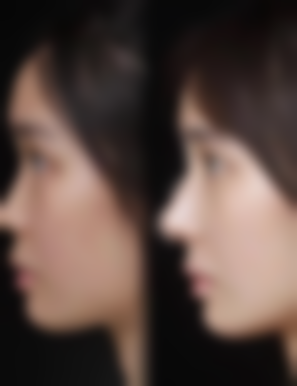 荆门爱优整形医院来院路线