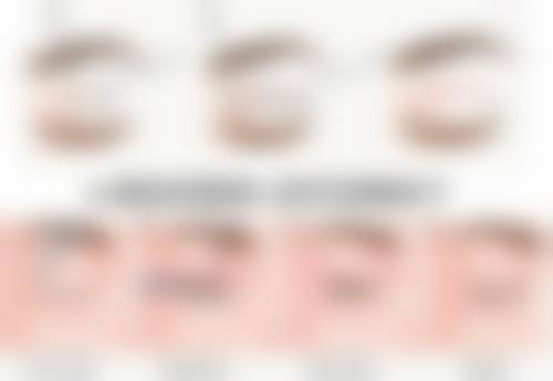 张芳梅医生可应用的成熟医美技术