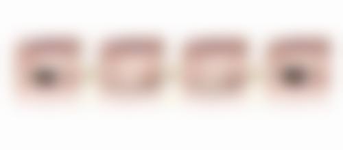 北海博铧整形医院求美者反馈