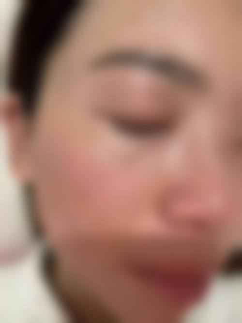 羊山圣德医疗美容门诊部求美者反馈