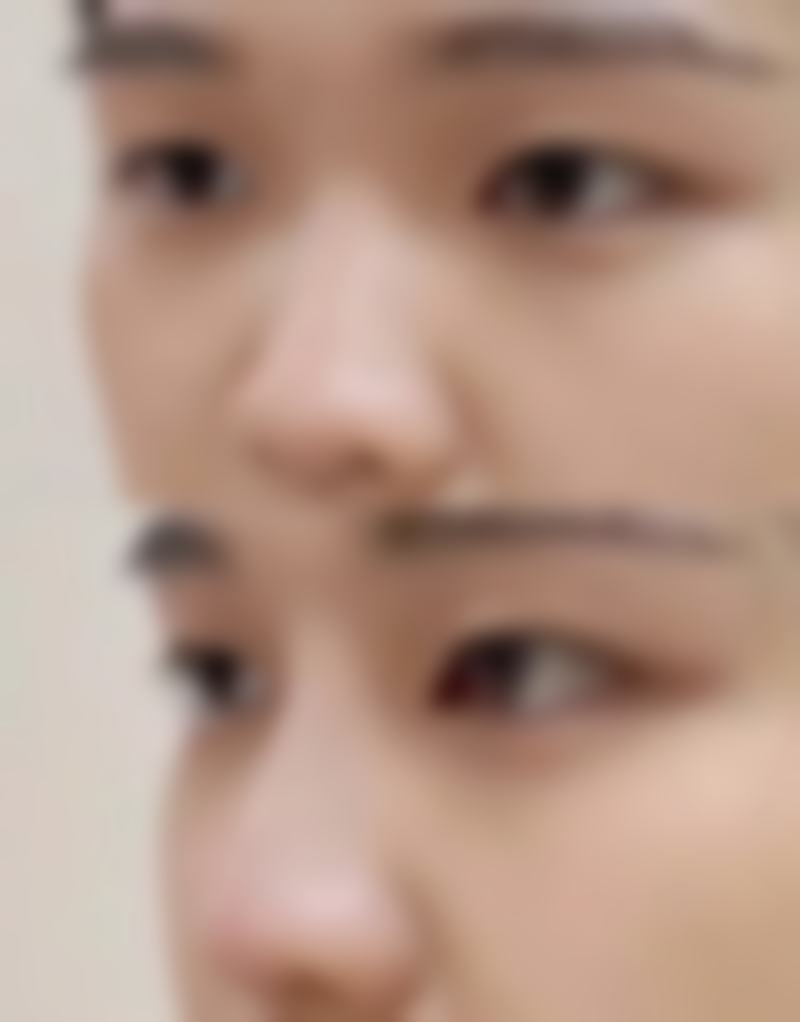 南京益佳医疗美容诊所求美者反馈