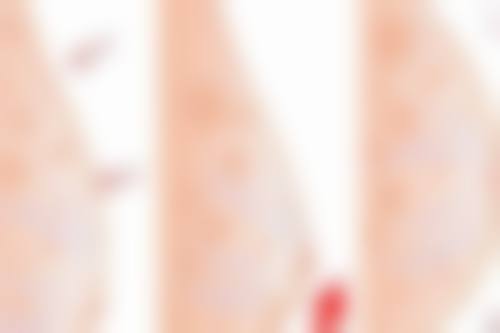 昆山清颜秀整形医院特色项目及技术优势