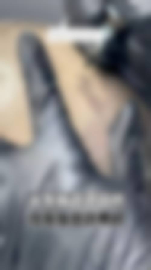 重庆李梅博士植发中 心求美者反馈