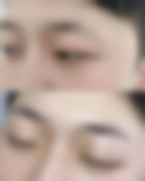 重庆李梅博士植发中 心医生团队实力