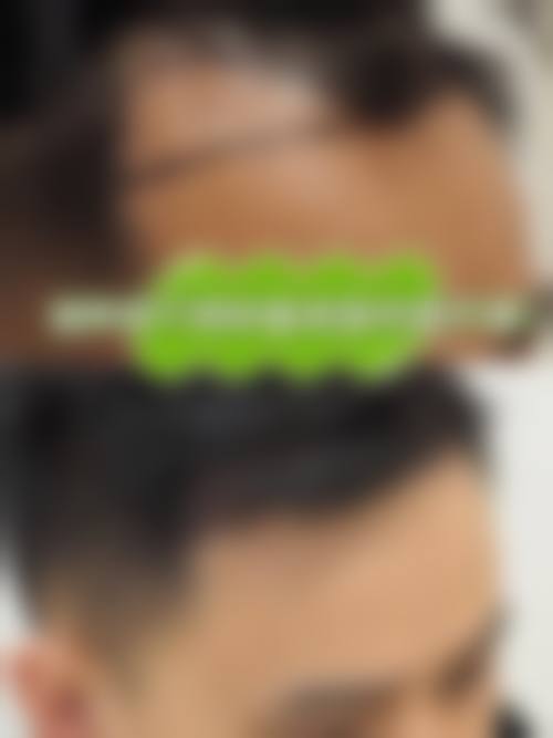 重庆李梅博士植发中 心价格收费