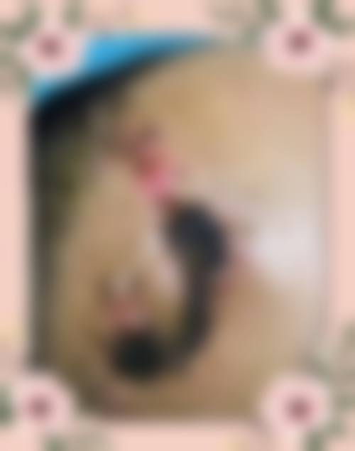 重庆李梅博士植发中 心特色项目及技术优势