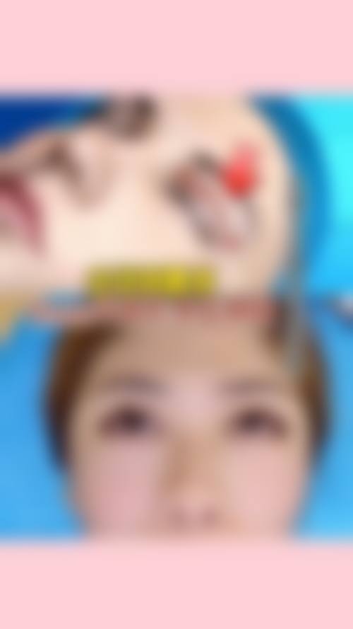 Noblenco整形外科求美者反馈