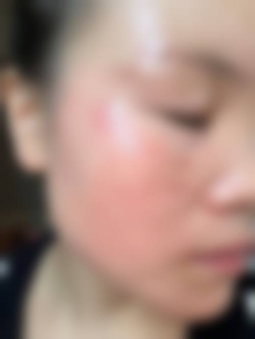 韩国首尔丽格皮肤科医院求美者反馈