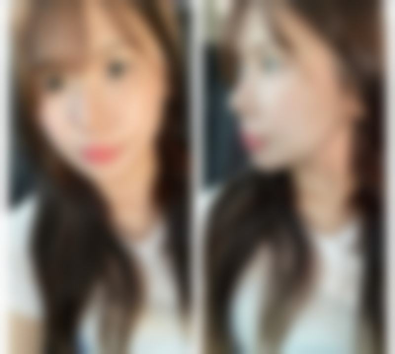 韩国首尔丽格皮肤科医院特色项目及技术优势