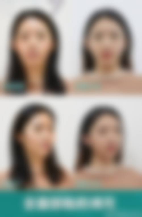 昆明悦莱医疗整形美容价格收费