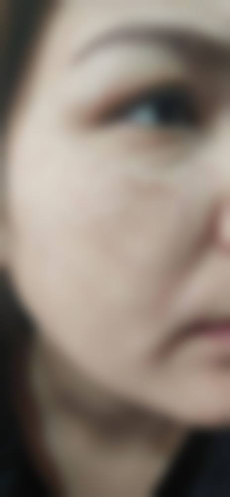 依托鸡西Dr.W王医生整形医院的专精平台优势