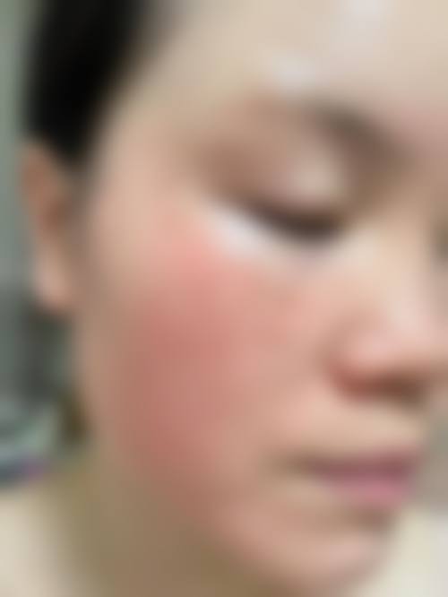 晏晓青医生的专项技术亮点
