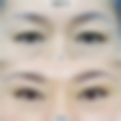 重庆五洲整形求美者反馈