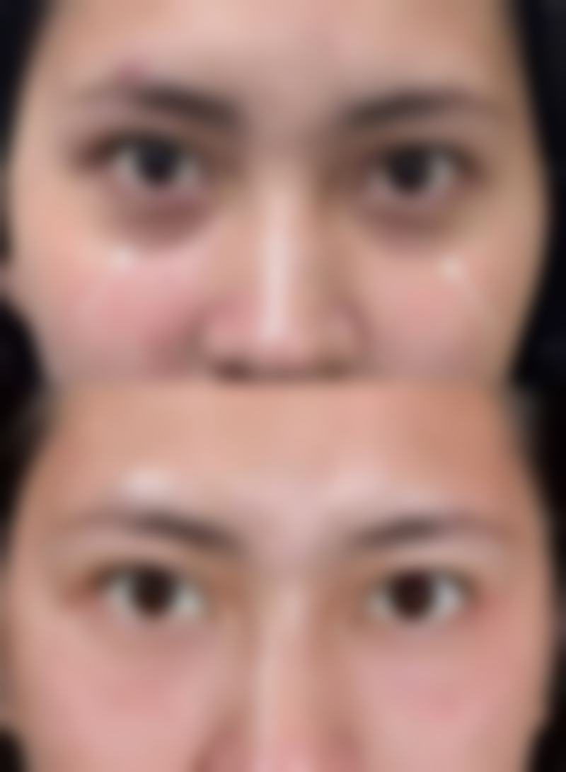 钦州挚妍整形医院求美者反馈