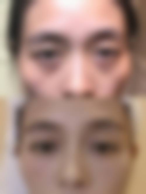 马满仓医生的手术理念：安心为先，兼顾成效与体验