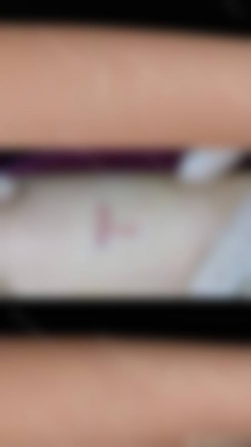 长沙微丽丝（原微恩）医疗美容门诊部求美者反馈