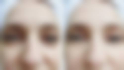 南昌皓颜整形医院求美者反馈