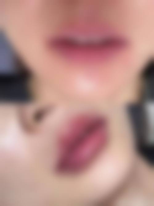 河源李陵峰美容诊所价格收费