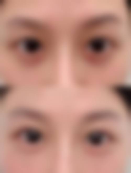 求美者真实反馈