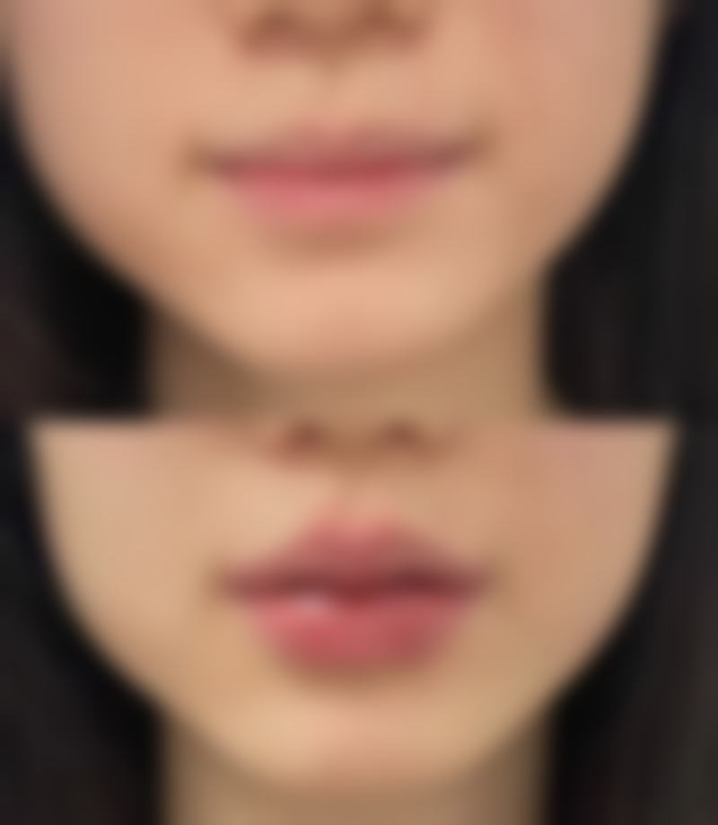 河源李陵峰美容诊所来院路线