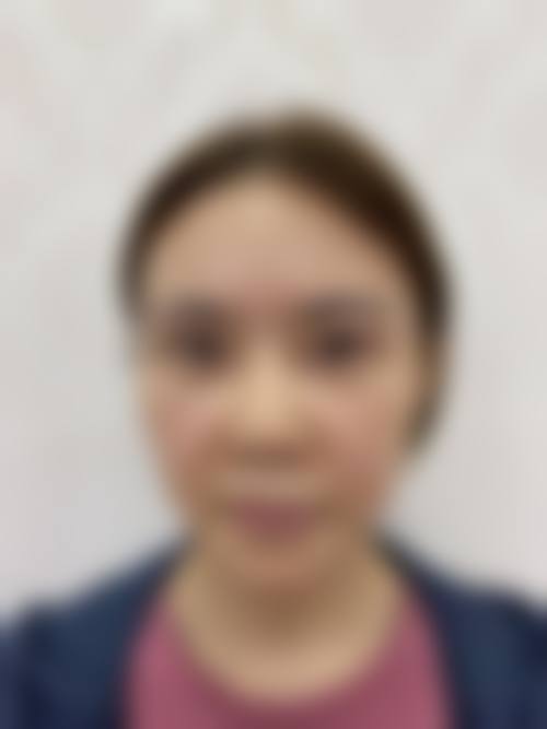崔金珍医生可开展的特色医美项目：聚焦专项技术与个性化定制